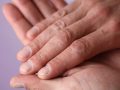 7 Easy Ways to Treat and Prevent Dry Cracked Hands