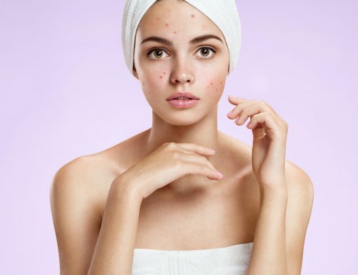 How to Reduce Pimple Redness